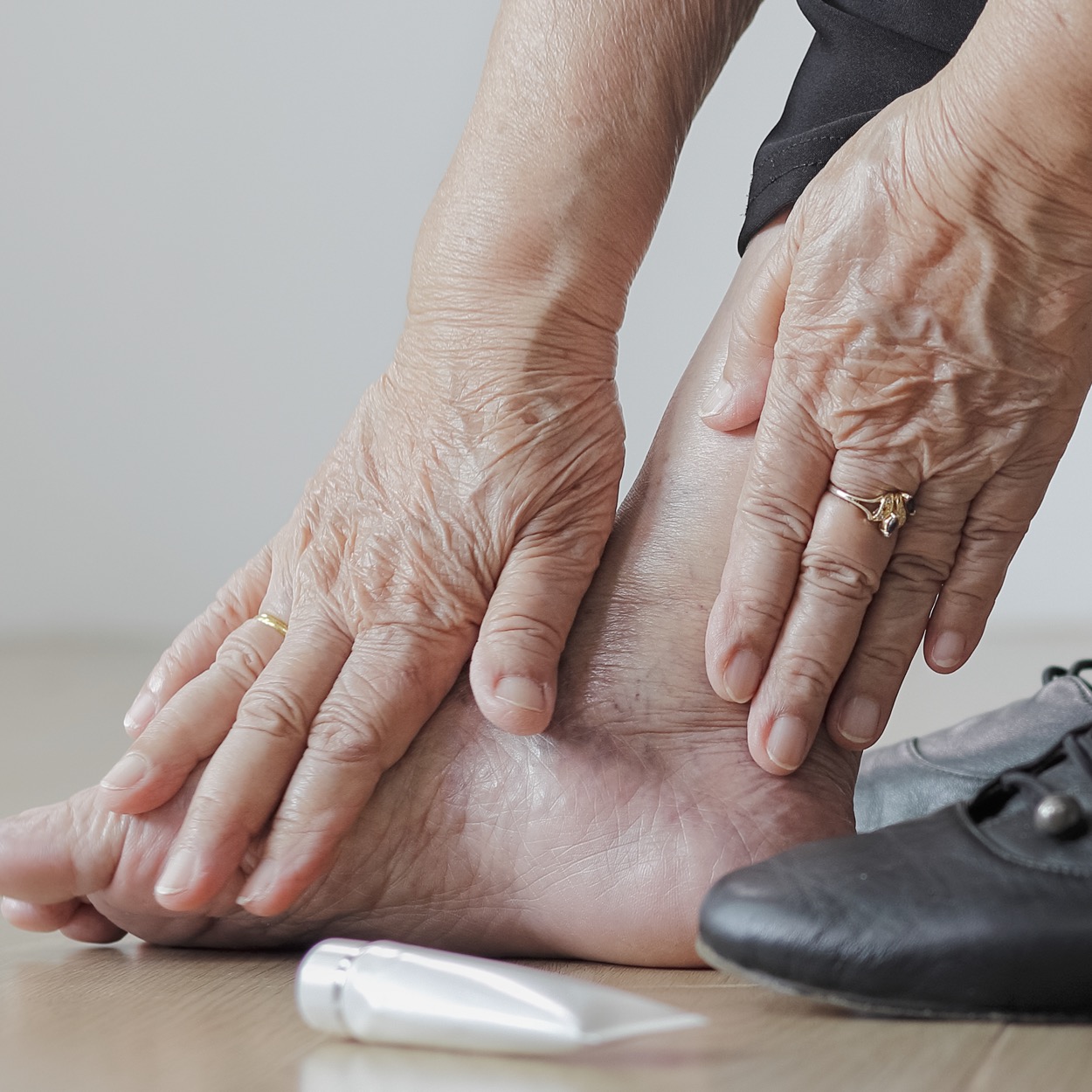 Foot and ankle areas commonly associated with chronic pain.